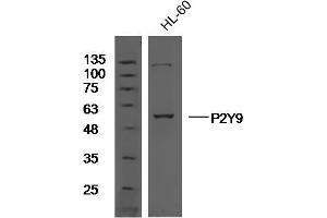 Human HL60 cell lysates probed with Rabbit Anti-P2Y9 Polyclonal Antibody, Unconjugated  at 1:300 overnight at 4˚C.