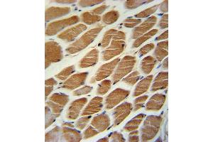 ACADL Antibody (Center) (ABIN652476 and ABIN2842324) immunohistochemistry analysis in formalin fixed and paraffin embedded human skeletal muscle followed by peroxidase conjugation of the secondary antibody and DAB staining. (ACADL 抗体  (AA 292-319))