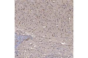 IHC analysis of NOB1 using anti-NOB1 antibody (ABIN7599344). (NOB1 抗体  (AA 1-389))