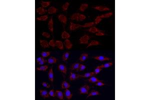 Immunofluorescence analysis of NIH/3T3 using Phospho-PDH-S293 Rabbit mAb (ABIN7269768) at dilution of 1:100 (40x lens). (PDHA1 抗体  (pSer293))