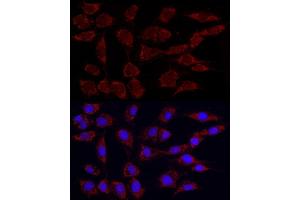 Immunofluorescence analysis of NIH/3T3 using Phospho-PDH-S293 Rabbit mAb (ABIN7269768) at dilution of 1:100 (40x lens). (PDHA1 抗体  (pSer293))