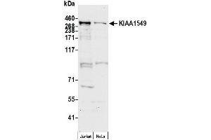 anti-KIAA1549 (KIAA1549) (AA 1450-1500) antibody