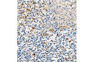 Immunohistochemistry (Paraffin-embedded Sections) (IHC (p)) image for anti-Colony Stimulating Factor 1 (Macrophage) (CSF1) antibody (ABIN7073553)