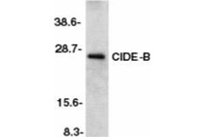 Image no. 1 for anti-Cell Death-Inducing DFFA-Like Effector B (CIDEB) (AA 204-219) antibody (ABIN201953) (CIDEB 抗体  (AA 204-219))