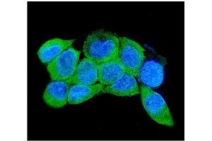 IF analysis of IRAK2 using anti-IRAK2 antibody (ABIN7602761).