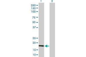 Western Blot analysis of IFNA5 expression in transfected 293T cell line by IFNA5 MaxPab polyclonal antibody. (IFNA5 抗体  (AA 1-189))
