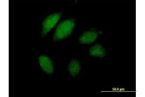 Immunofluorescence of purified MaxPab antibody to JTV1 on HeLa cell. (AIMP2 抗体  (AA 1-320))