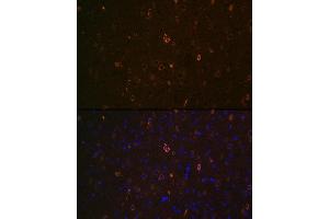 Immunofluorescence (IF) image for anti-ATP-Binding Cassette, Sub-Family A (ABC1), Member 2 (ABCA2) (AA 2307-2466) antibody (ABIN7265728)