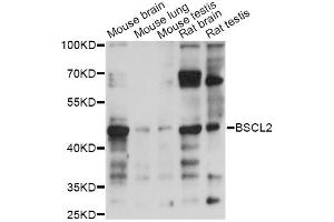 Western blot analysis of extracts of various cell lines, using BSCL2 antibody (ABIN6293870) at 1:1000 dilution. (BSCL2 抗体)