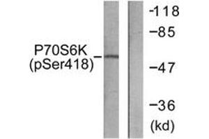 Western blot analysis of extracts from HT29 cells treated with serum 20% 15', using p70 S6 Kinase (Phospho-Ser418) Antibody.