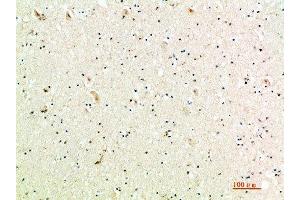 Immunohistochemical analysis of paraffin-embedded human-brain, antibody was diluted at 1:200 (CXCL9 抗体  (AA 90-125))