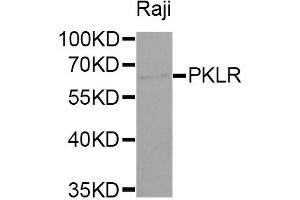 Western Blotting (WB) image for anti-Pyruvate Kinase, Liver and RBC (PKLR) antibody (ABIN1874148) (PKLR 抗体)