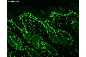 Immunohistochemistry analysis using Mouse Anti-Acetylated Lysine Monoclonal Antibody, Clone 7F8 (ABIN361802 and ABIN361803). (Lysine (lys) (acetylated) 抗体)