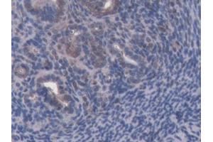 Immunohistochemistry (IHC) image for anti-ATP-Binding Cassette, Sub-Family B (MDR/TAP), Member 8 (ABCB8) (AA 468-717) antibody (ABIN5013188)