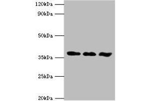 Western blot All lanes: ACVR1 antibody at 6 μg/mL Lane 1: A549 whole cell lysate Lane 2: HepG2 whole cell lysate Lane 3: Mouse gonad tissue Secondary Goat polyclonal to rabbit IgG at 1/10000 dilution Predicted band size: 39 kDa Observed band size: 39 kDa (ACVR1 抗体  (AA 20-125))