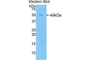 Western Blotting (WB) image for anti-Peroxiredoxin 3 (PRDX3) (AA 64-257) antibody (ABIN1860307) (Peroxiredoxin 3 抗体  (AA 64-257))