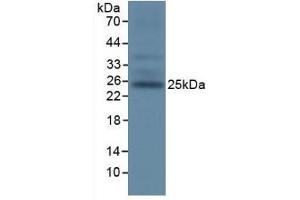 Detection of TIGIT in Mouse Spleen Tissue using Polyclonal Antibody to T-Cell Immunoreceptor With Ig And ITIM Domains Protein (TIGIT)
