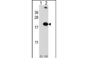 Western blot analysis of RBM3 (arrow) using rabbit polyclonal RBM3 Antibody (Center) (ABIN391593 and ABIN2841522).