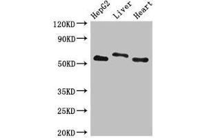 Western Blot Positive WB detected in: HepG2 whole cell lysate, Rat liver tissue, Mouse heart tissue All lanes: SLC13A5 antibody at 2. (SLC13A5 抗体  (AA 156-204))