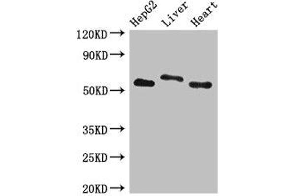 SLC13A5 anticorps  (AA 156-204)