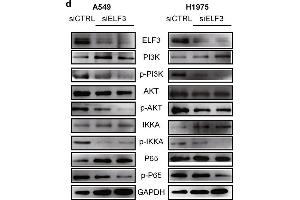 ELF3 can be induced by IL1B and promotes tumor growth through PI3K/AKT/NF-κB pathway. (ELF3 抗体  (AA 1-280))