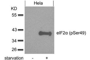 Western blot analysis of extracts from Hela cells untreated or treated with starvation using eIF2a(phospho-Ser49) Antibody. (EIF2S1 抗体  (pSer49))