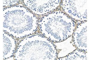 ABIN6259689 and ABIN6278305 at 1/100 staining Rat testis tissue by IHC-P. (CX3CL1 抗体  (C-Term))