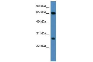 KBTBD8 antibody (70R-10021) used at 0. (KBTBD8 抗体  (N-Term))