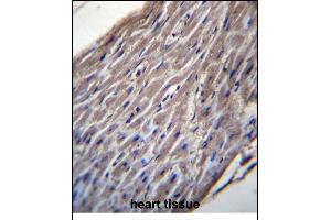BVES Antibody (C-term) (ABIN656934 and ABIN2846126) immunohistochemistry analysis in formalin fixed and paraffin embedded human heart tissue followed by peroxidase conjugation of the secondary antibody and DAB staining. (BVES 抗体  (C-Term))
