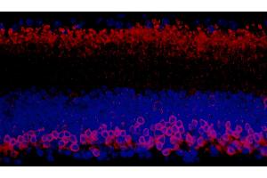 Immunofluorescence (IF) image for anti-Protein Kinase C, alpha (PKCa) (AA 622-672) antibody (ABIN7453397)