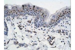 Image no. 1 for anti-General Transcription Factor III (GTF2I) (AA 208-257) antibody (ABIN6735929) (GTF2I 抗体  (AA 208-257))