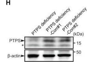 Western Blotting (WB) image for anti-6-Pyruvoyltetrahydropterin Synthase (PTS) antibody (ABIN2856764)