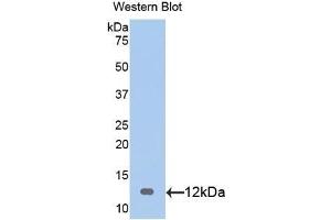 Detection of Recombinant S100, Rat using Polyclonal Antibody to S100 Calcium Binding Protein (S100) (S100 Protein (S100) (AA 1-94) 抗体)