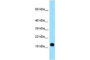 WB Suggested Anti-LCE3C Antibody Titration: 1. (LCE3C 抗体  (Middle Region))