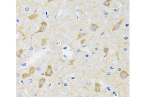 Immunohistochemistry of paraffin-embedded Mouse brain using HSPH1 Polyclonal Antibody at dilution of 1:100 (40x lens). (HSPH1 抗体)