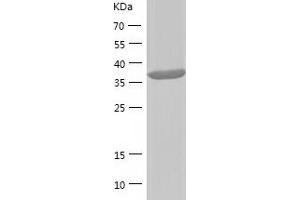 Western Blotting (WB) image for SUMO1 Activating Enzyme Subunit 1 (SAE1) (AA 1-346) protein (His tag) (ABIN7289211) (SAE1 Protein (AA 1-346) (His tag))