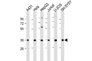 All lanes : Anti-NT5C3 Antibody (C-Term) at 1:2000 dilution Lane 1: A431 whole cell lysate Lane 2: Hela whole cell lysate Lane 3: HepG2 whole cell lysate Lane 4: Jurkat whole cell lysate Lane 5: U-2OS whole cell lysate Lane 6: SH-SY5Y whole cell lysate Lysates/proteins at 20 μg per lane. (NT5C3 抗体  (AA 282-313))