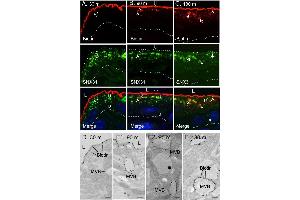 The endocytosed apical urothelial proteins are targeted to the SNX31-positive MVBs. (Biotin 抗体)
