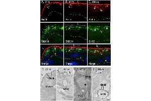 The endocytosed apical urothelial proteins are targeted to the SNX31-positive MVBs.