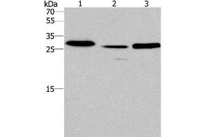 IRAK1BP1 Antikörper