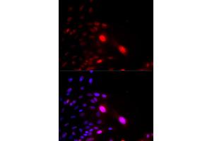 Immunofluorescence analysis of U2OS cells using DDB2 antibody (ABIN5970947). (DDB2 抗体)