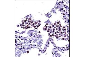 TLR8 Antibody (Center) ((ABIN657933 and ABIN2846877))immunohistochemistry analysis in formalin fixed and paraffin embedded human lung tissue followed by peroxidase conjugation of the secondary antibody and DAB staining. (TLR8 抗体  (AA 434-463))