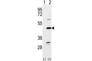 Western blot analysis of BMP7 antibody and 293 cell lysate either nontransfected (Lane 1) or transiently transfected with the BMP7 gene (2). (BMP7 抗体  (AA 15-44))