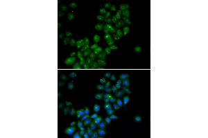 Immunofluorescence (IF) image for anti-Calcium Activated Nucleotidase 1 (CANT1) antibody (ABIN1980357) (CANT1 抗体)