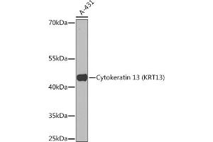 Western blot analysis of extracts of A-431 cells, using Cytokeratin 13 (Cytokeratin 13 (KRT13)) Rabbit pAb (ABIN7268090) at 1:1000 dilution. (Cytokeratin 13 抗体  (AA 269-458))