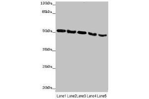 Western blot All lanes: INPP5K antibody at 4. (INPP5K 抗体  (AA 149-448))