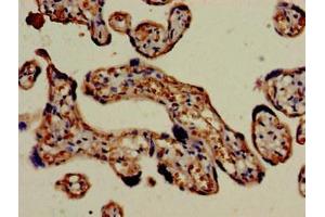 Immunohistochemistry (IHC) image for anti-Fc Fragment of IgG, Low Affinity IIIa, Receptor (CD16a) (FCGR3A) (AA 49-184) antibody (ABIN7158547)