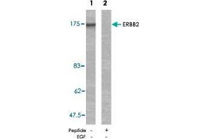Western blot analysis of extracts from MDA-MB-231 cells using ERBB2 polyclonal antibody  . (ErbB2/Her2 抗体)