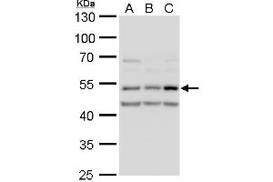 WB Image CaMK2D antibody detects CaMK2D protein by western blot analysis. (CAMK2D 抗体)