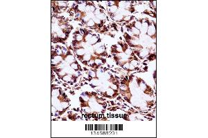 AIP Antibody immunohistochemistry analysis in formalin fixed and paraffin embedded human rectum tissue followed by peroxidase conjugation of the secondary antibody and DAB staining. (AIP 抗体  (C-Term))